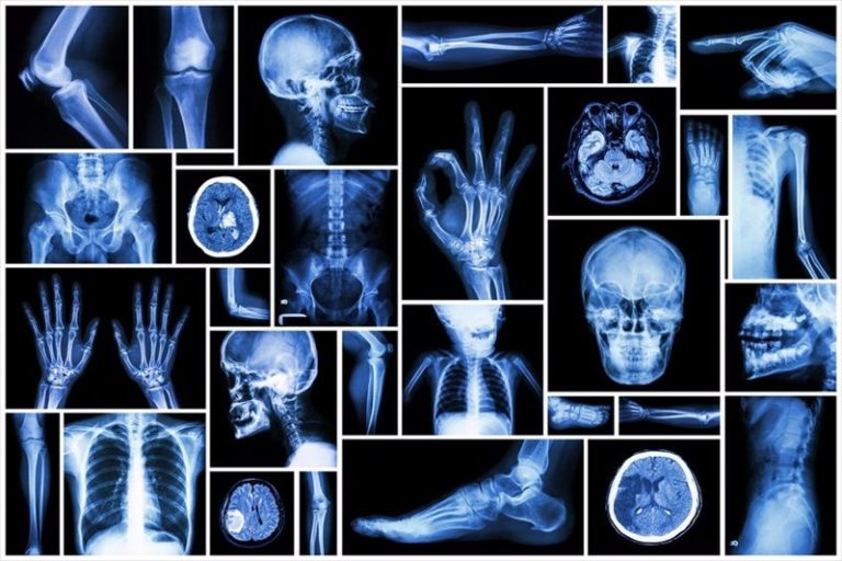 X-ray